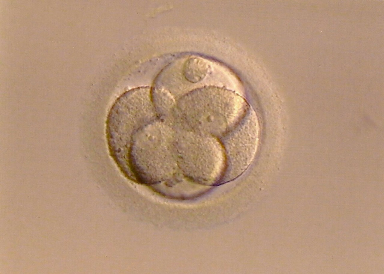 ステッド ハッチング アシ 体外受精での双子、三つ子